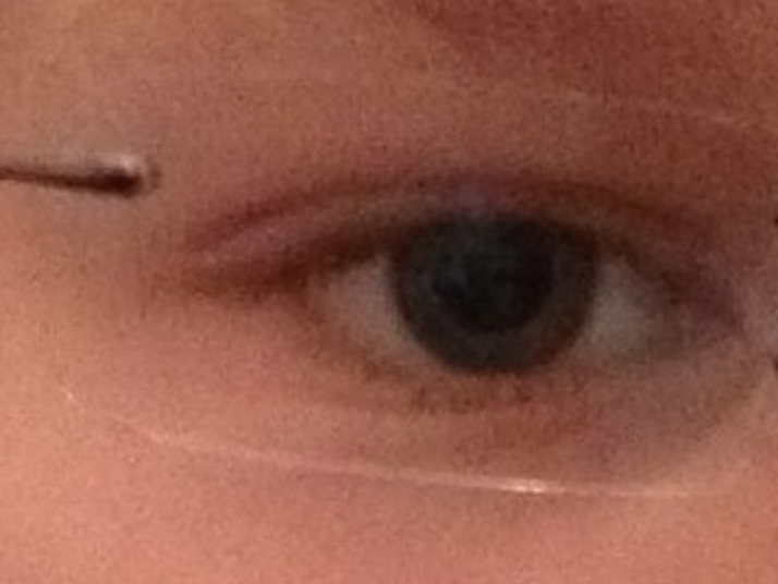 Jonas hat ne Brille